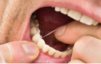 Ex-aluna de Odontologia fala sobre uso correto do fio dental no site de Drauzio Varella